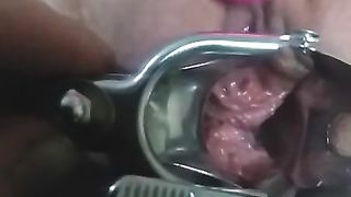 Close up Speculum and Internal Veiw of Squirting