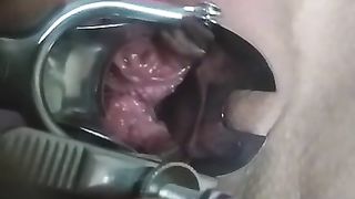 Close up Speculum and Internal Veiw of Squirting