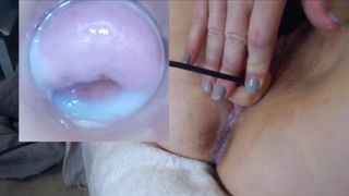 Inside Vagina Creamy Cervix Bihg Dildo Camera Real Orgasm