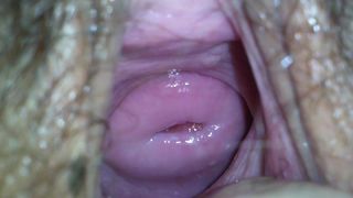 A Beautiful Cervix